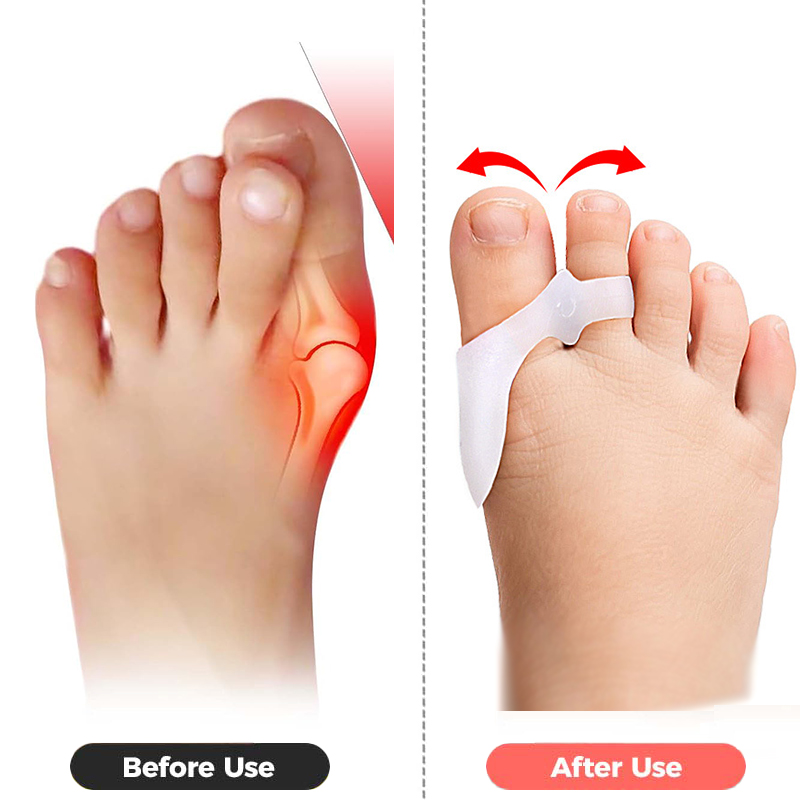 Pexmen 2/4Pcs Toe Spacers Buni - Power Tools Kids のレビューと価格